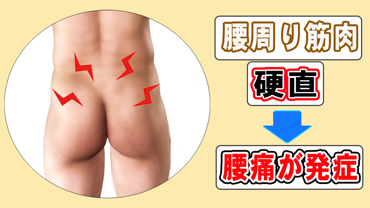 腰痛原因 腰痛原因